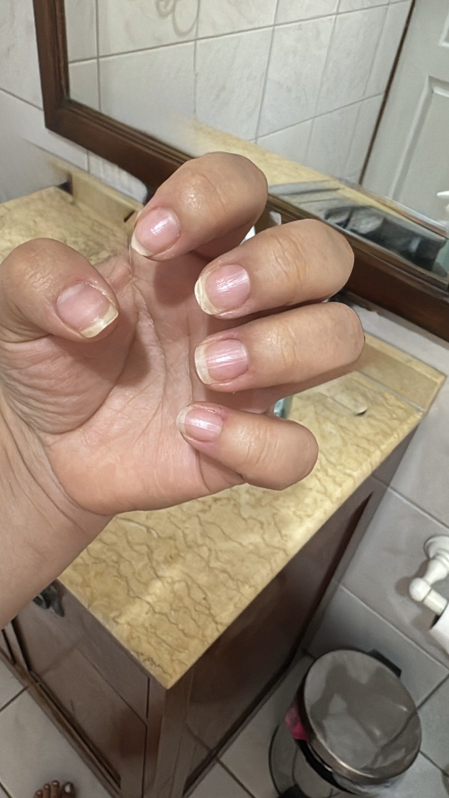 Antes - Uñas